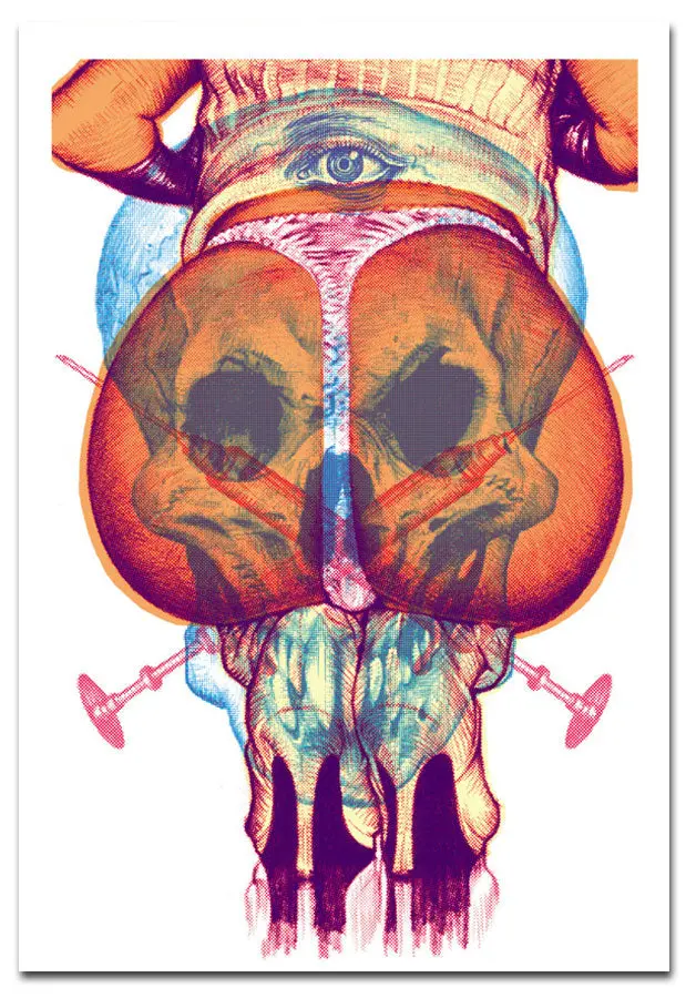 "Trash Brain" Silk Screen Print 1